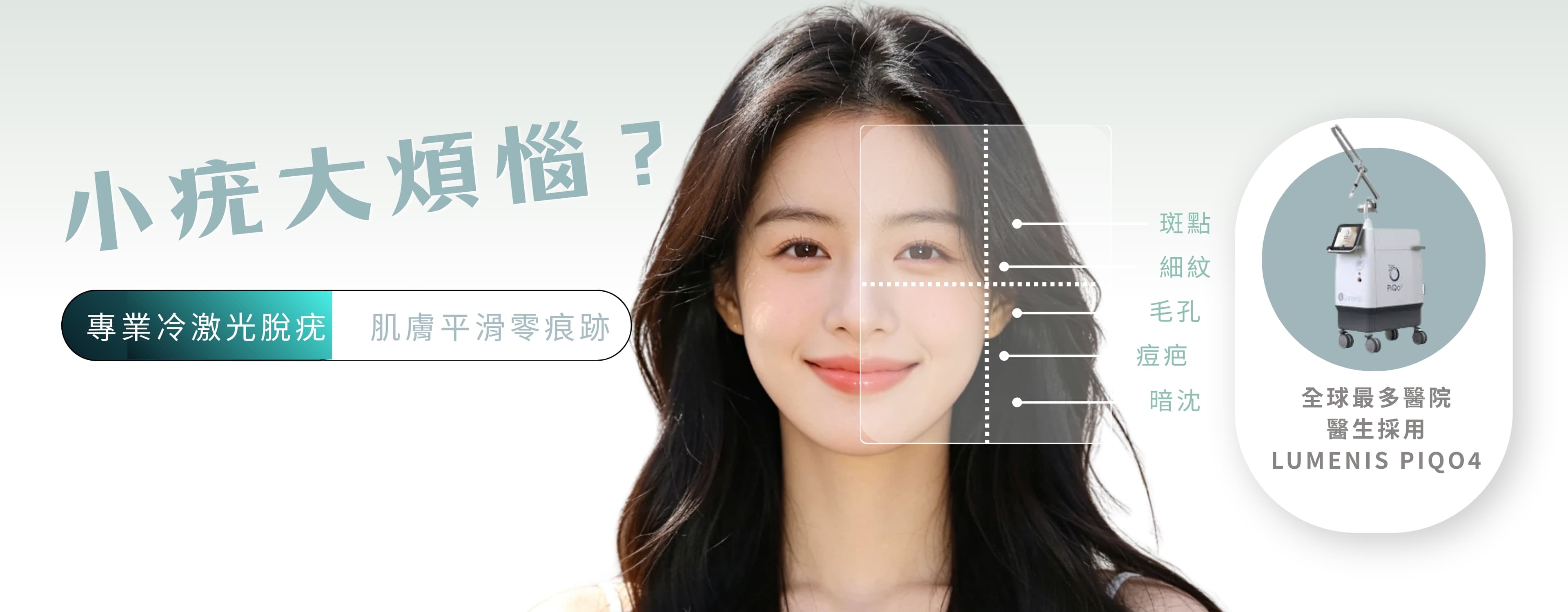 激光脫疣療程