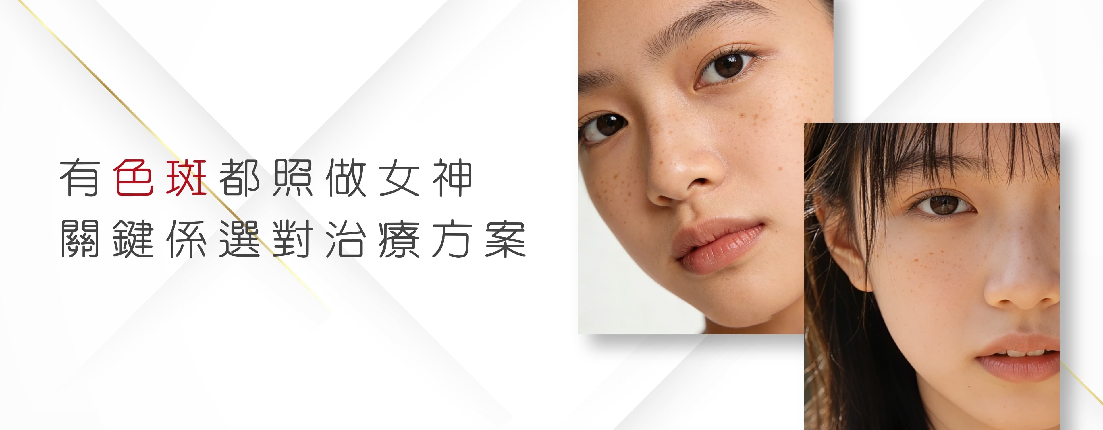 色斑及荷爾蒙斑 亮白活肌祛斑療程