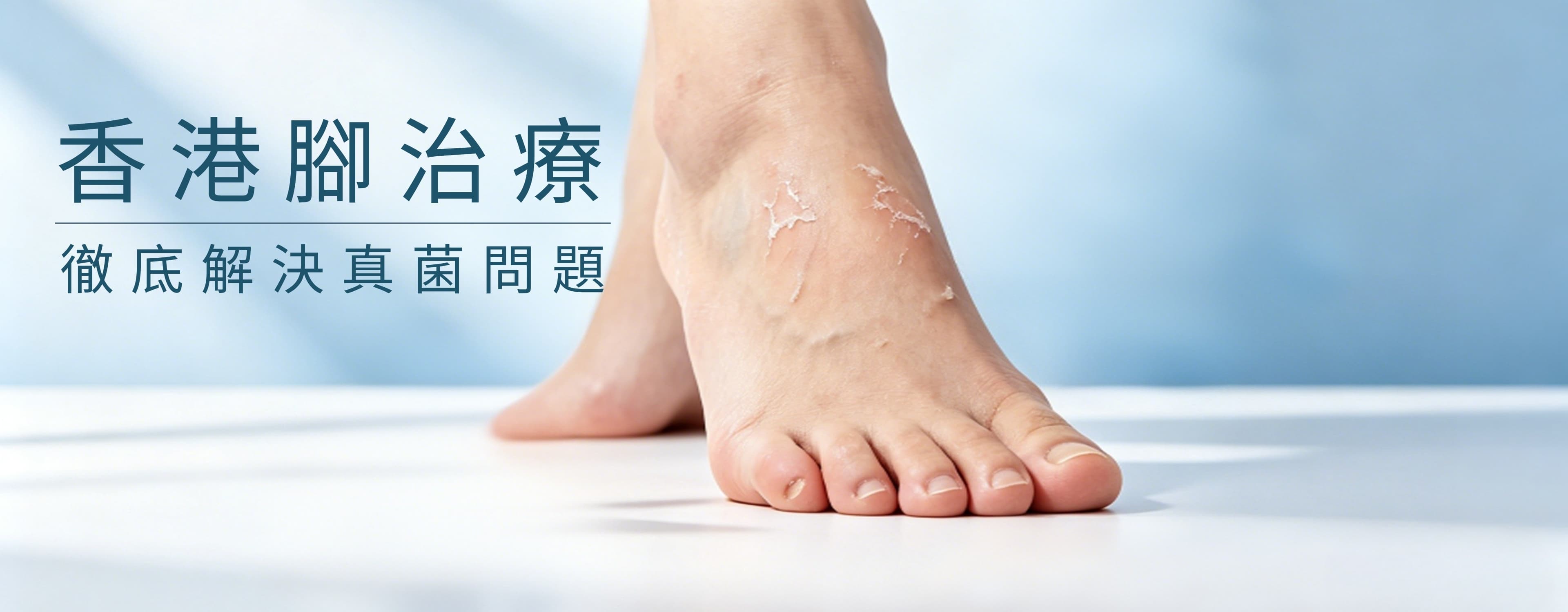 香港腳療程