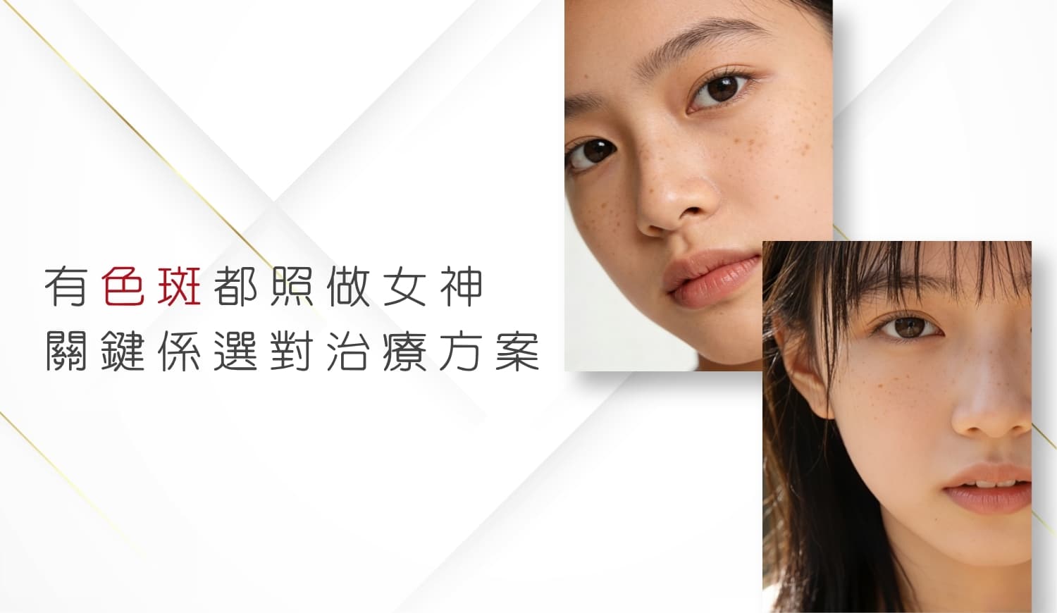 色斑及荷爾蒙斑 亮白活肌祛斑療程