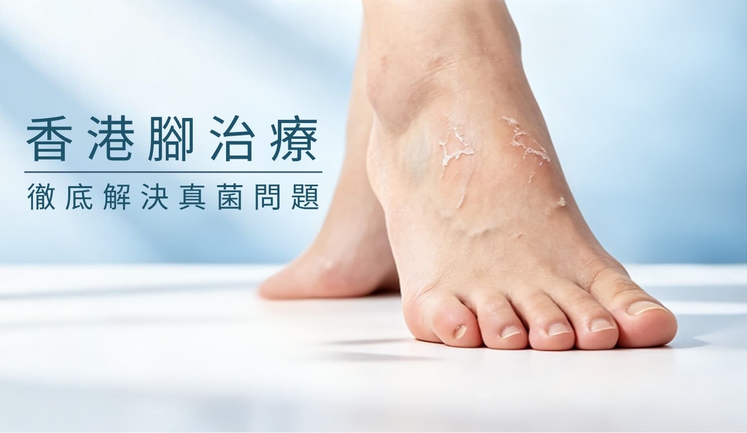 香港腳療程